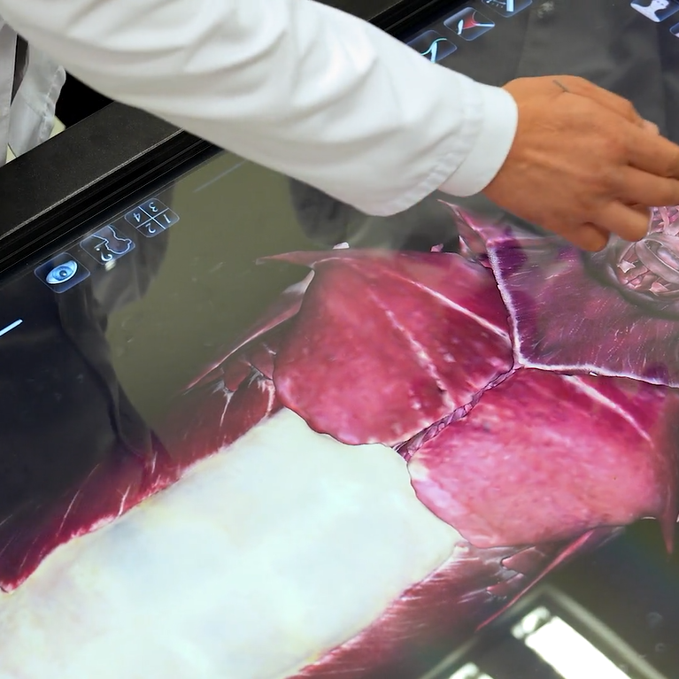 Miologi&yacute;a. Muskullar barada ylym. Kell&auml;niň muskullary. Anatomage 3D enjamynda amaly sapak.